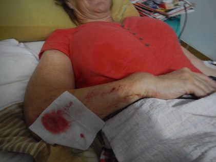 L's Wrist, VARTC Coffee, Biochar 001.JPG